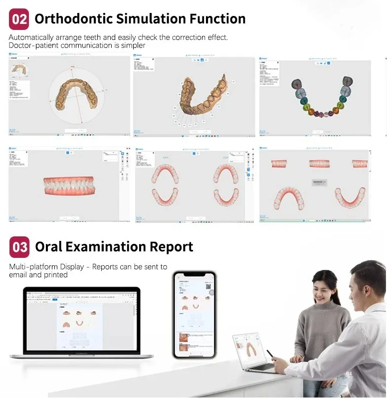 Runyes 3DS V5 Intraoral Scanner (IOS)