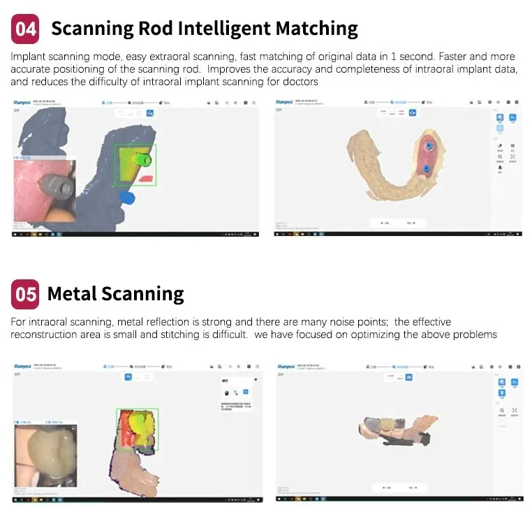 Runyes 3DS V5 Intraoral Scanner (IOS)