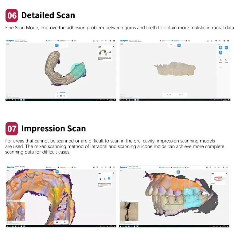 Runyes 3DS V5 Intraoral Scanner (IOS)