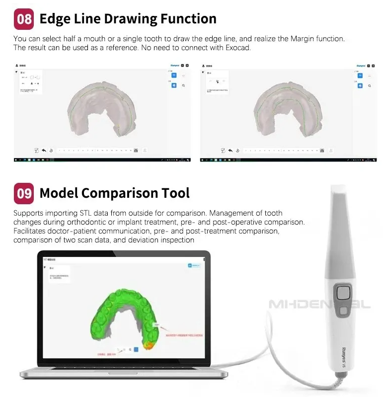 Runyes 3DS V5 Intraoral Scanner (IOS)