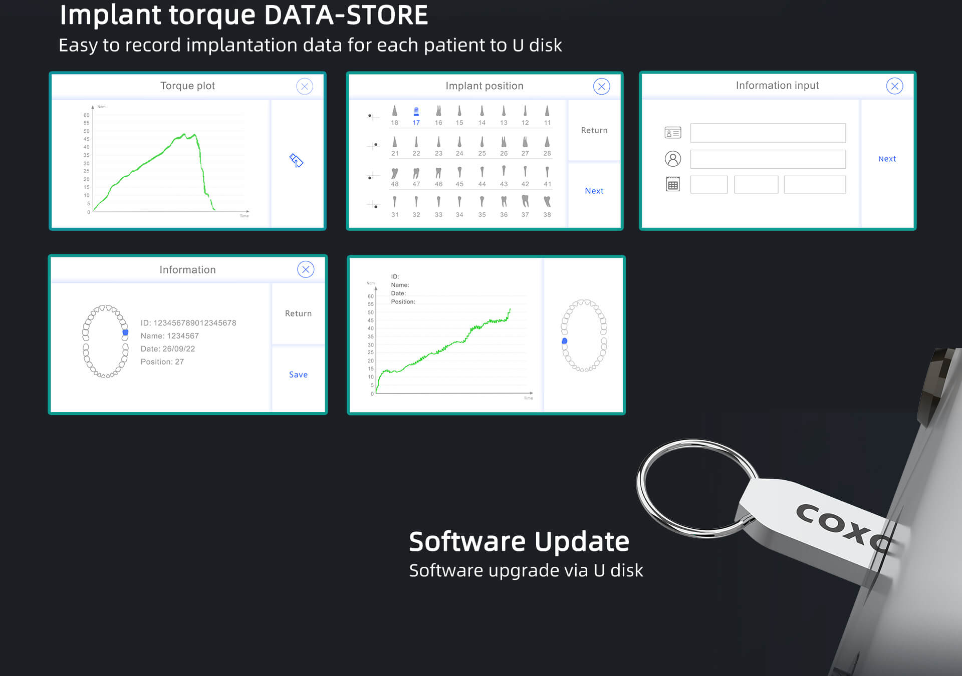 The COXO C-Sailor PRO+ Implant Motor-07