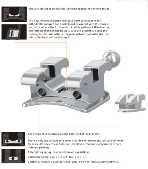 Light-force low friction ROTH brackets (Patented by Headway) - MBT Brackets