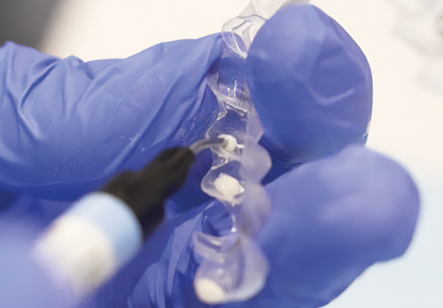 Voco AlignerFlow LC 2 Syringes x 2gm