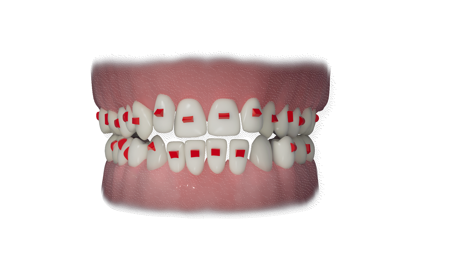 Voco AlignerFlow LC 2 Syringes x 2gm