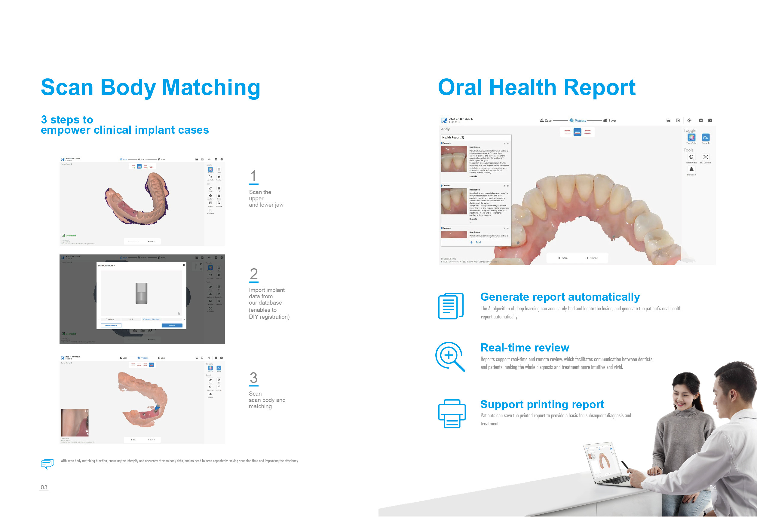 Runyes 3DS V3 PRO Intraoral Scanner
