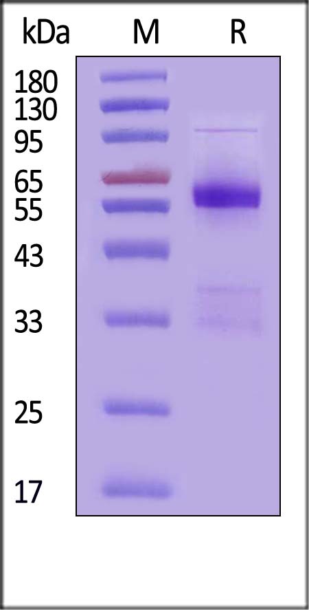SDS-PAGE Human USAG-1, Fc Tag on SDS-PAGE under reducing (R) condition. The gel was stained with Coomassie Blue. The purity of the protein is greater than 90% (With Star Ribbon Pre-stained Protein Marker).